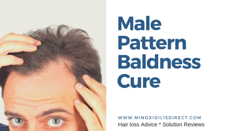 Is There A Cure for Male Pattern Baldness Minoxidil 15 Direct