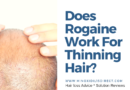 Does Rogaine Work For Thinning Hair