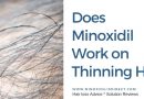 Does Minoxidil Work on Thinning Hair